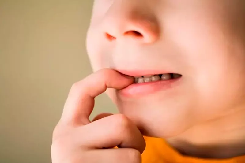 coronas de acero en odontopediatria en jesus maria